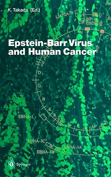 Epstein-Barr Virus and Human Cancer