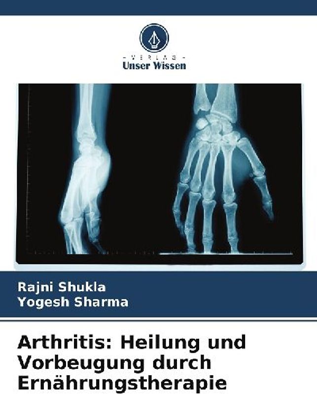 Arthritis: Heilung und Vorbeugung durch Ernährungstherapie