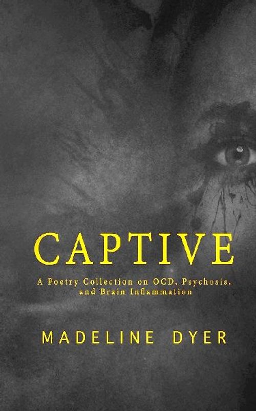 Captive