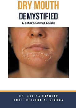 Dry mouth Demystified