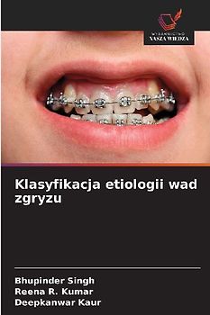 Klasyfikacja etiologii wad zgryzu