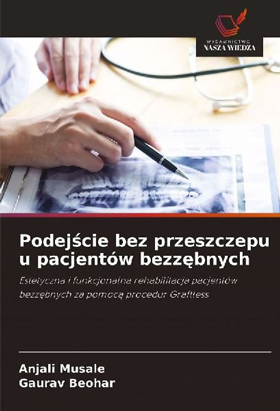 Podej¿cie bez przeszczepu u pacjentów bezz¿bnych