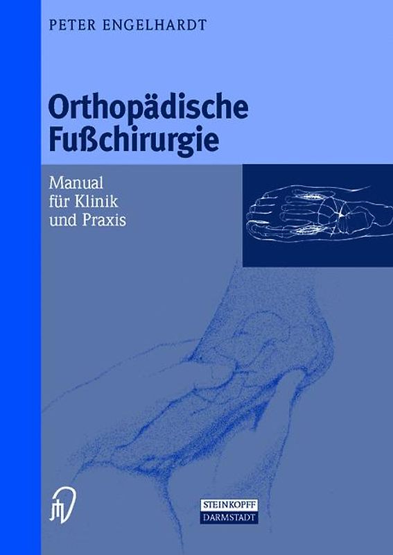 Orthopädische Fußchirurgie