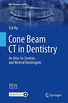 Cone Beam CT in Dentistry