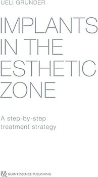 Implants in the Esthetic Zone