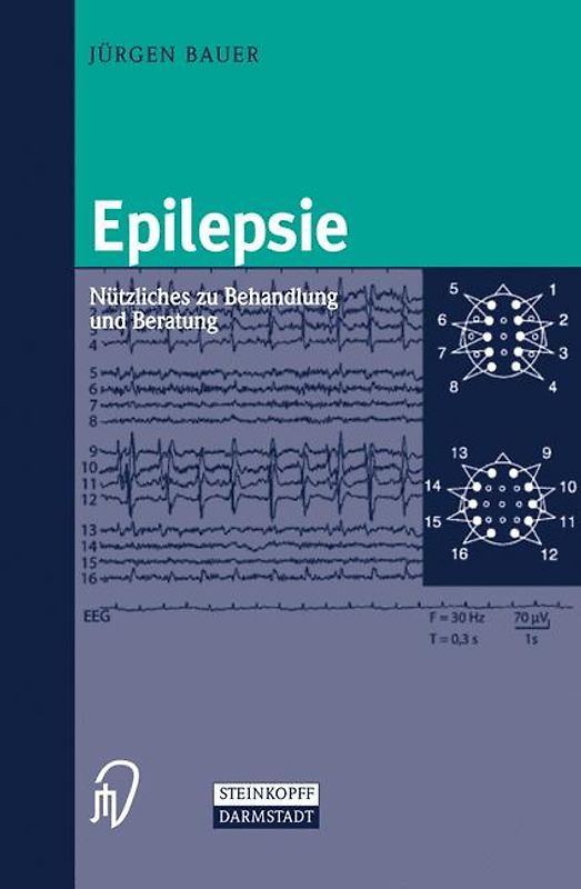 Epilepsie