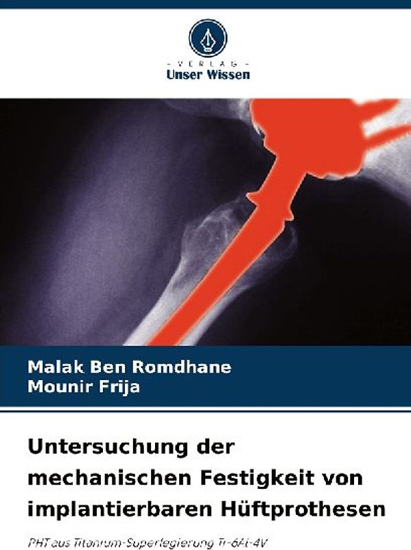 Untersuchung der mechanischen Festigkeit von implantierbaren Hüftprothesen