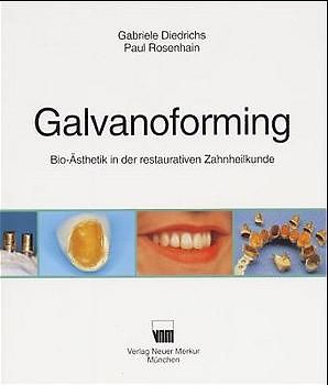 Galvanoforming