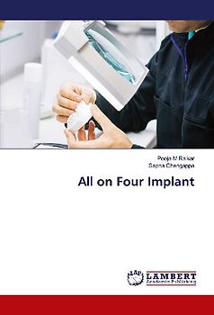 All on Four Implant