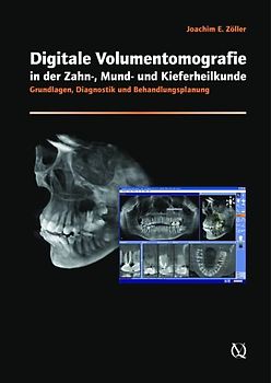 Digitale Volumentomografie in der Zahnmedizin