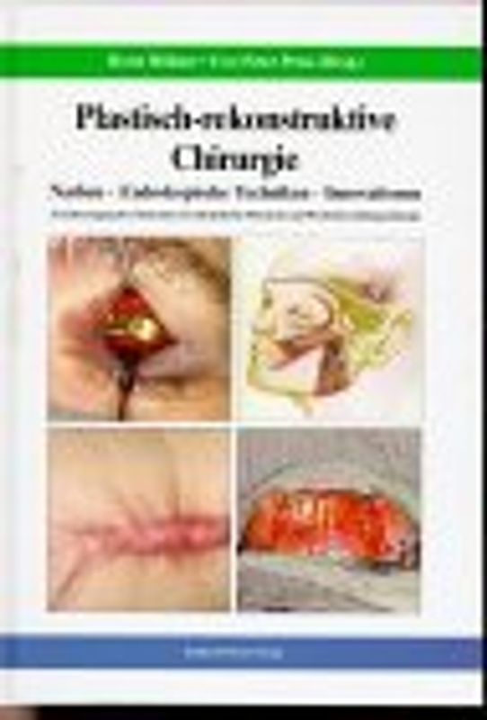 Plastisch-rekonstruktive Chirurgie