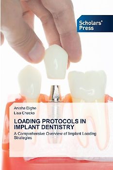 LOADING PROTOCOLS IN IMPLANT DENTISTRY