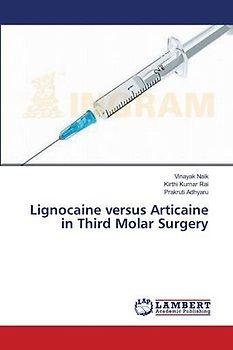 Lignocaine versus Articaine in Third Molar Surgery