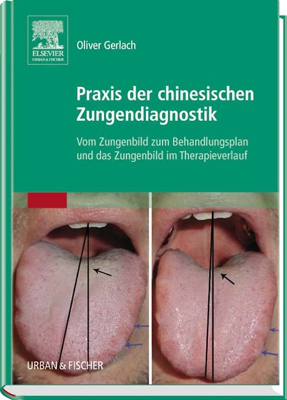 Praxis der chinesischen Zungendiagnostik
