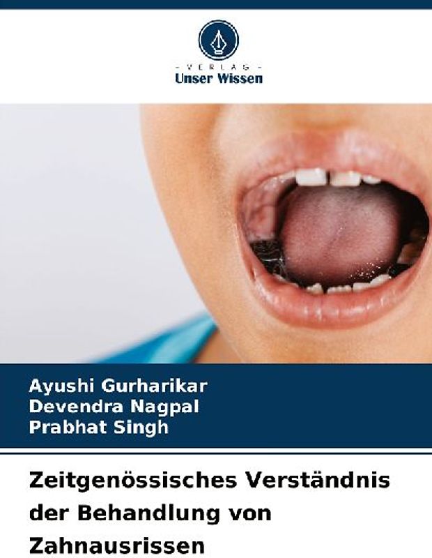 Zeitgenössisches Verständnis der Behandlung von Zahnausrissen