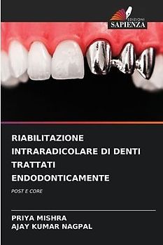 RIABILITAZIONE INTRARADICOLARE DI DENTI TRATTATI ENDODONTICAMENTE