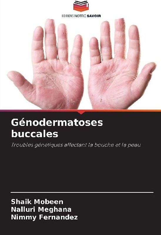 Génodermatoses buccales