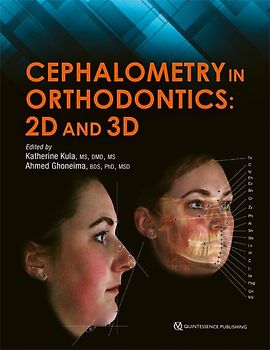 Cephalometry in Orthodontics: 2D and 3D