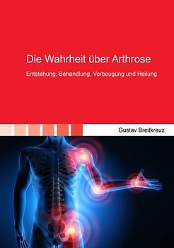 Die Wahrheit über Arthrose