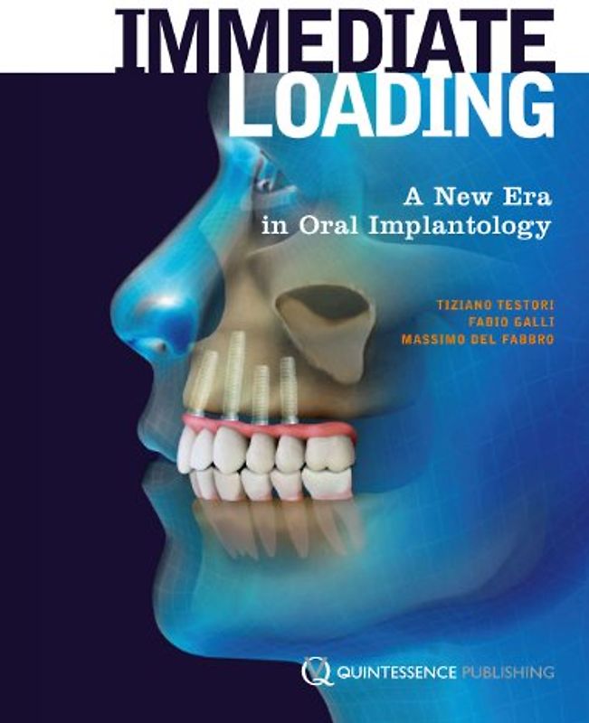 Immediate Loading: A New Era in Oral Implantology - Tiziano Testori