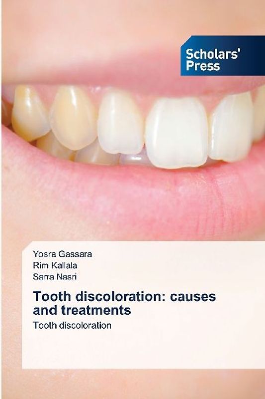 Tooth discoloration: causes and treatments