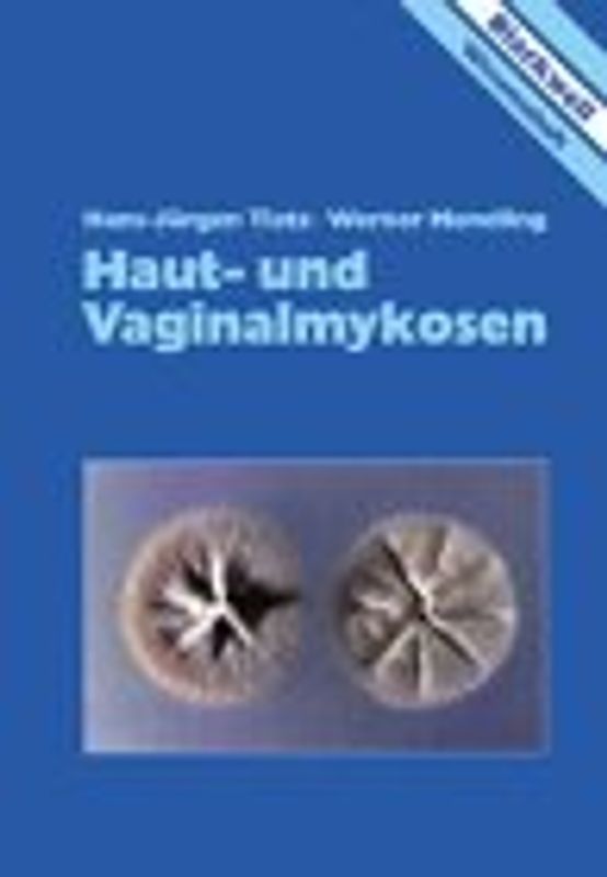 Haut- und Vaginalmykosen