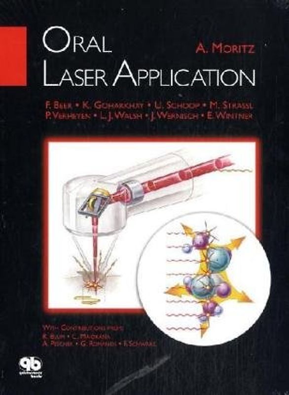 Oral Laser Application