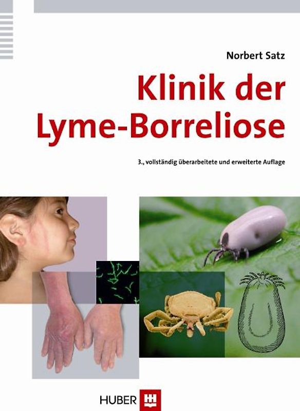 Klinik der Lyme-Borreliose
