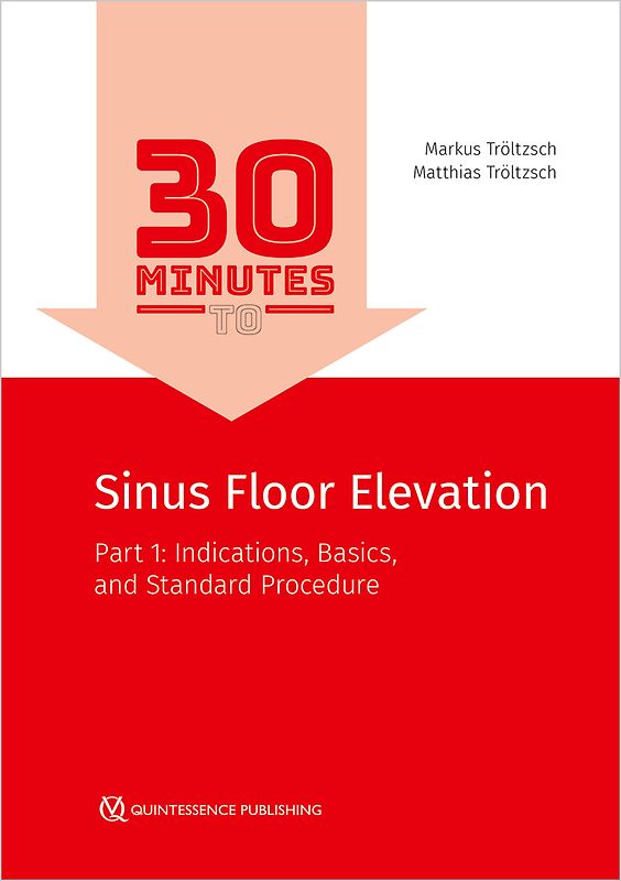 30 Minutes to Sinus Floor Elevation