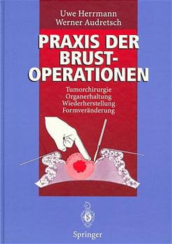 Praxis der Brustoperationen