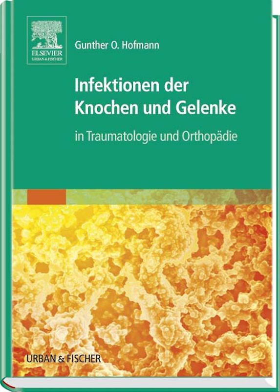 Infektionen der Knochen und Gelenke