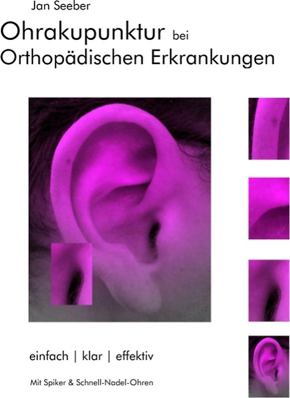 Ohrakupunktur bei Orthopädischen Erkrankungen