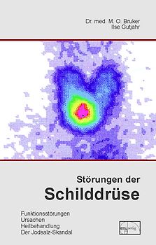 Störungen der Schilddrüse