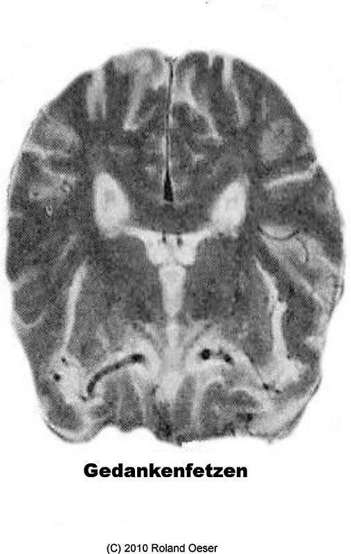 Gedankenfetzen