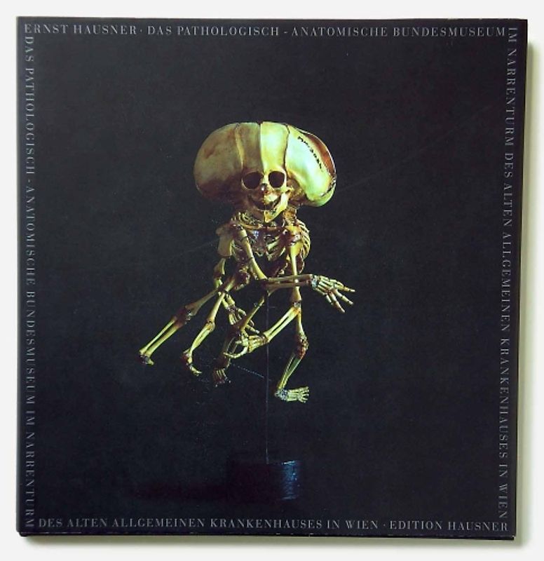 Das Pathologisch-Anatomische Bundesmuseum im Narrenturm des Alten Allgemeinen Krankenhauses