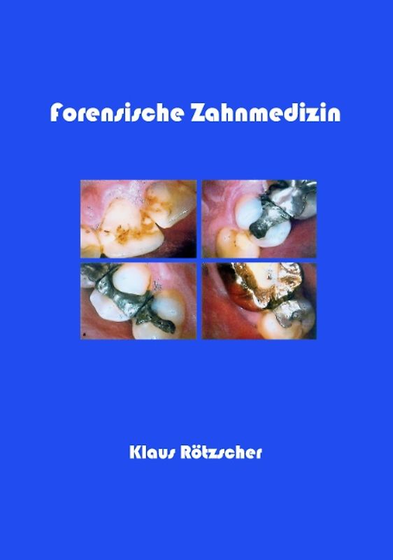 Forensische Zahnmedizin