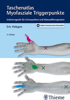 Taschenatlas Myofasziale Triggerpunkte
