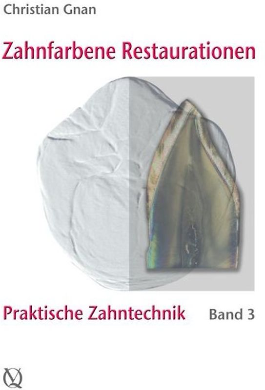 Zahnfarbene Restaurationen