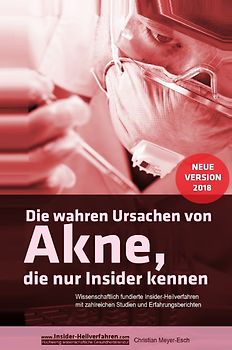 Die wahren Ursachen von Akne, die nur Insider kennen