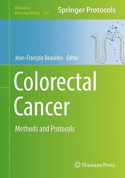 Colorectal Cancer