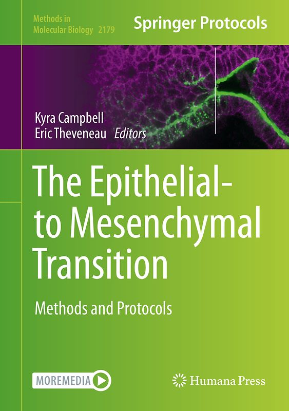 The Epithelial-to Mesenchymal Transition