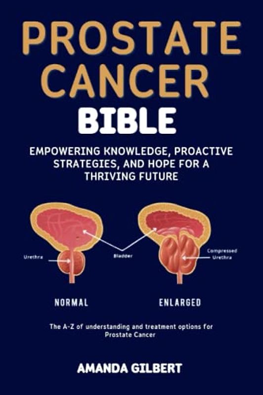 Prostate Cancer Bible: Empowering Knowledge, Proactive Strategies, and Hope for a Thriving Future