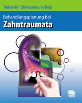 Behandlungsplanung bei Zahntraumata