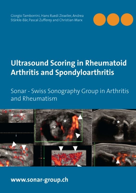 Ultrasound Scoring in Rheumatoid Arthritis and Spondyloarthritis