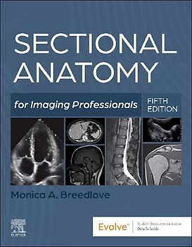 Sectional Anatomy for Imaging Professionals