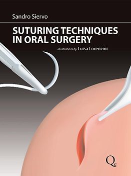 Suturing Techniques in Oral Surgery