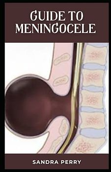 Guide to Meningocele: Meningocele is a type of spina bifida.