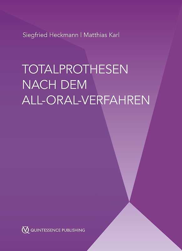 Totalprothesen nach dem All-Oral-Verfahren