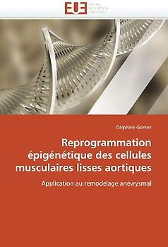 Reprogrammation épigénétique des cellules musculaires lisses aortiques