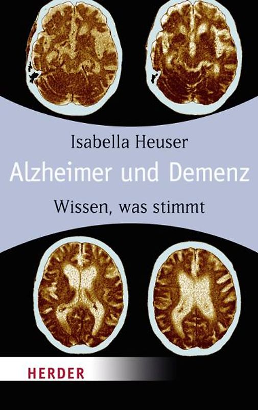 Alzheimer und Demenz